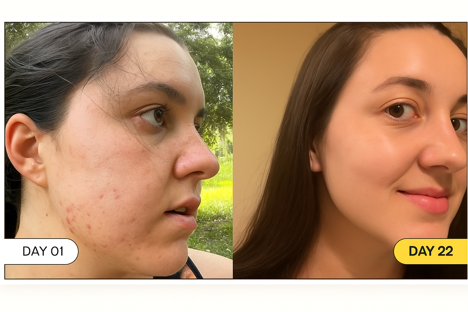 Skin transformation - Day 01 and Day 22
